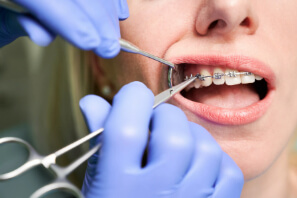 servicio de ortodoncia de imi villa dental